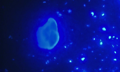 Innovative Home Device Targets Elusive Micro and Nanoplastics in Drinking Water