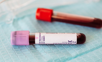 Scientists Discover an Ultra-Rare Blood Type Found in Only Three Individuals Worldwide