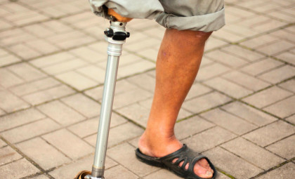 Scientists Unlock Mammalian Potential to Regenerate Lost Limbs Using Key Protein Sequence