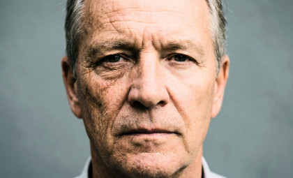 Decades of Driving Caused One Side of Driver’s Face to Age Prematurely Due to Sun Exposure